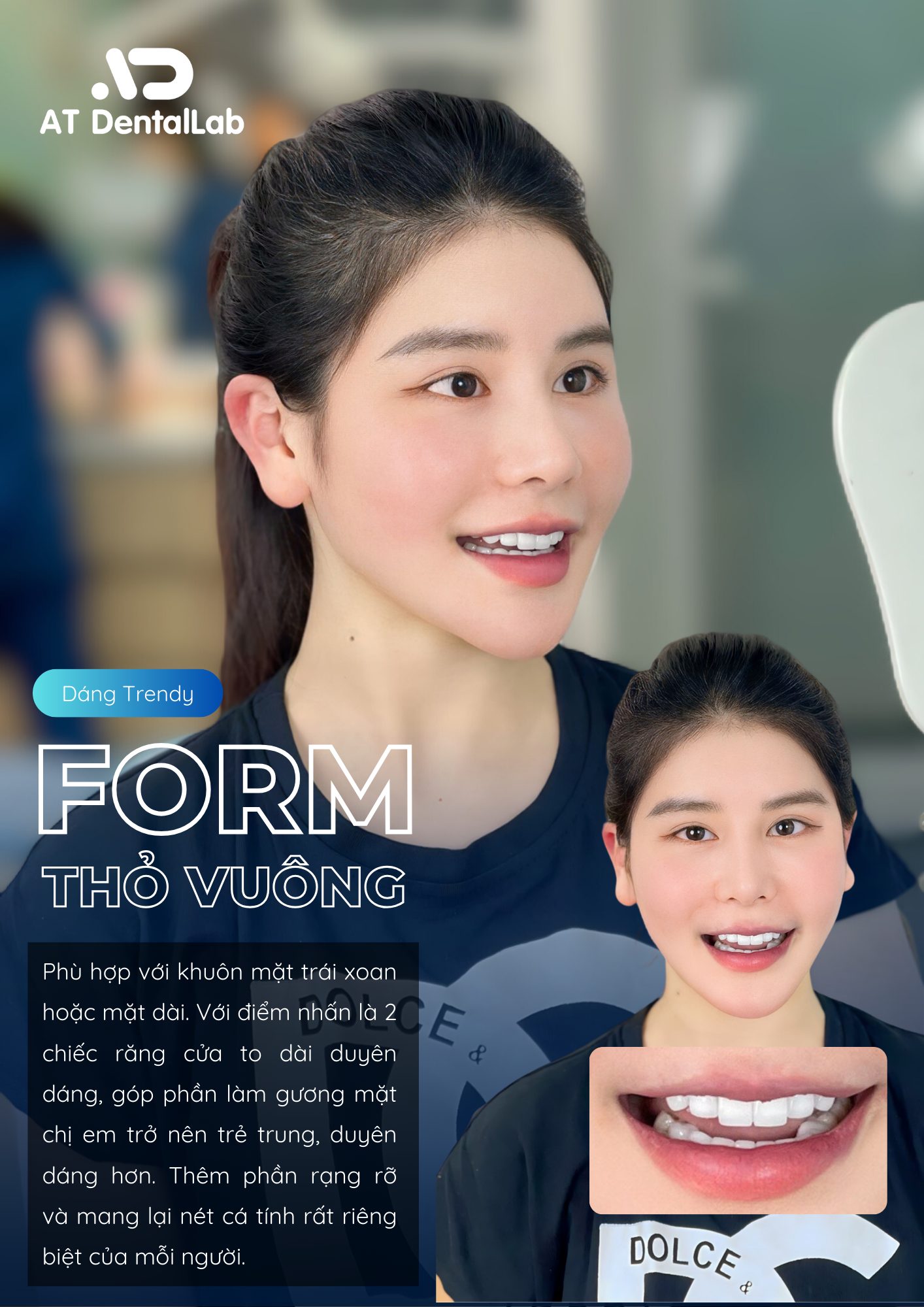 20 Răng Zirconia